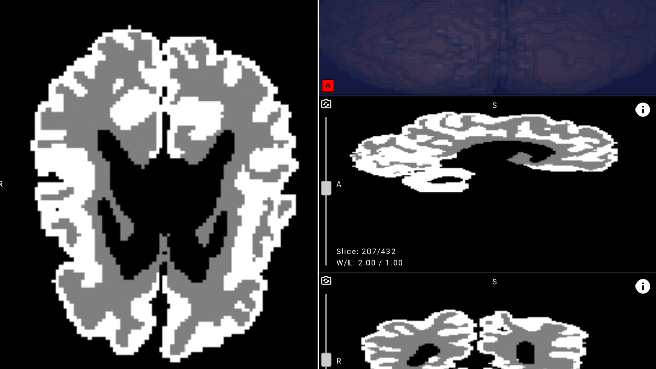 bebek beynini analiz eden yapay zeka erken teshisi kolaylastiriyor KfyuLZK4.png